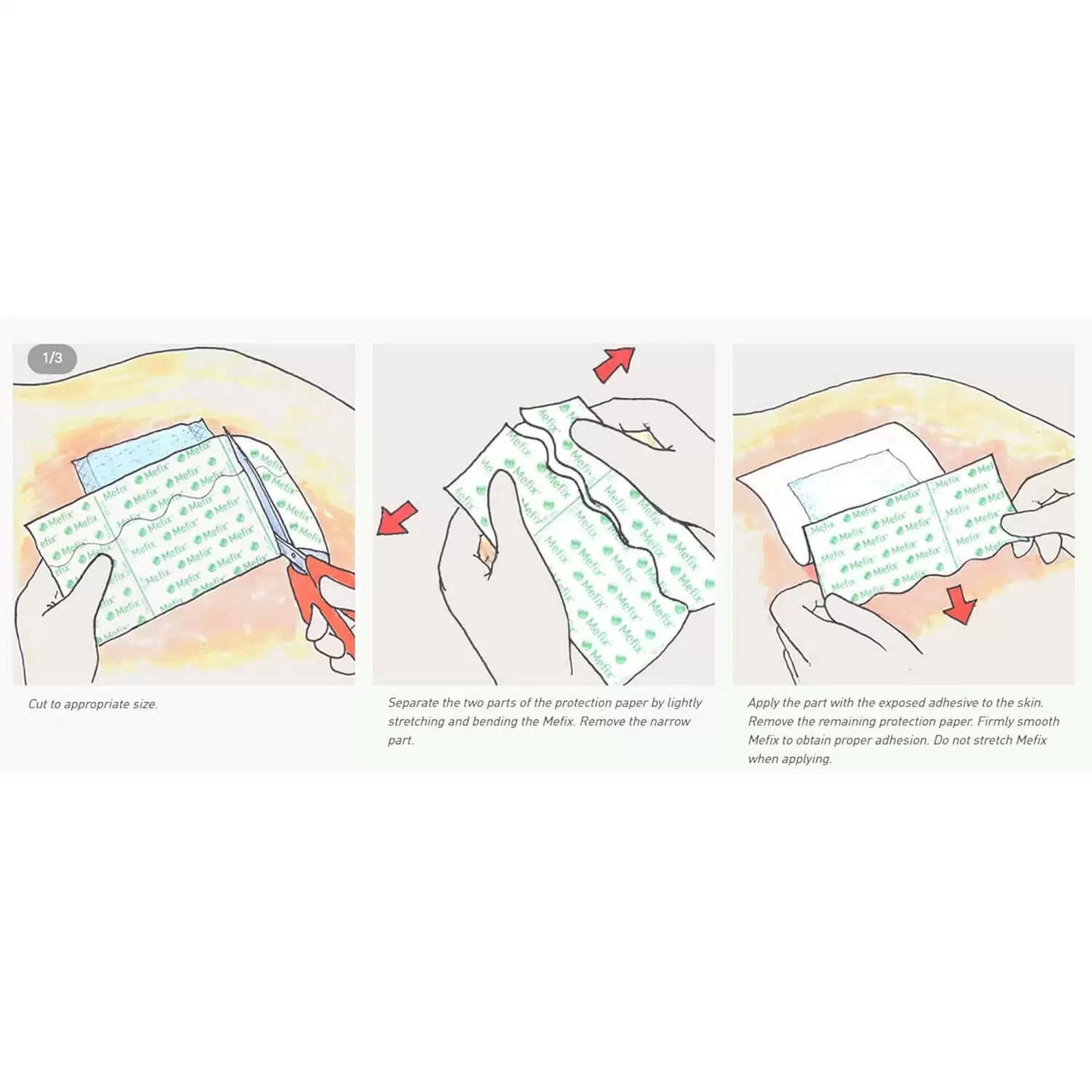 Mefix Dressing 5cm x 10m